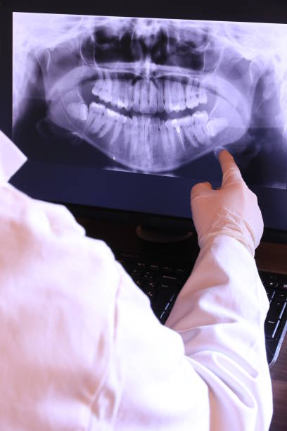 Best Emergency Tooth Extraction in Rockville, IN
